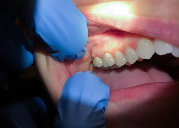 Best Walk-In Emergency Dentist in Hobart, OK